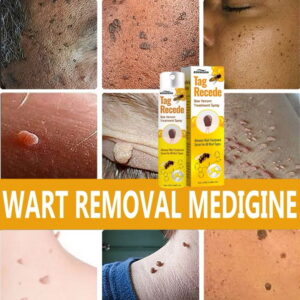 Tag recede bee venom spary wart remover buang tahi lalat ubat kutil ketuat remover skin tag mole remover smooth skin (Copy)